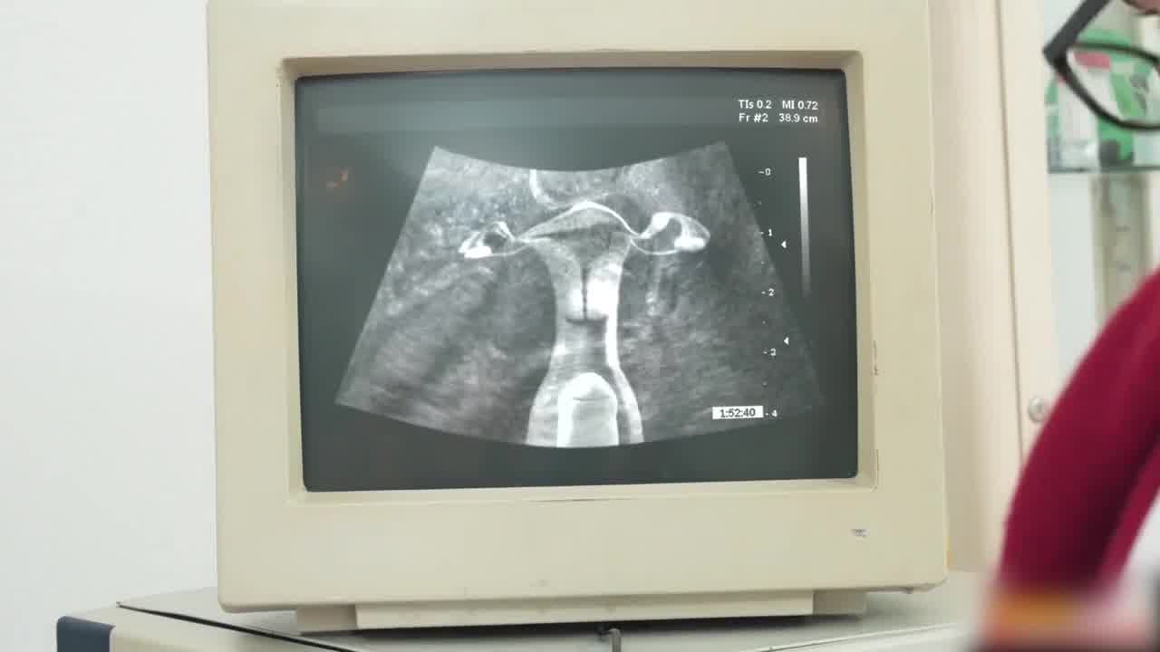  医生在老公面前超音波插入妻子的无毛鲍鱼 的剧照10